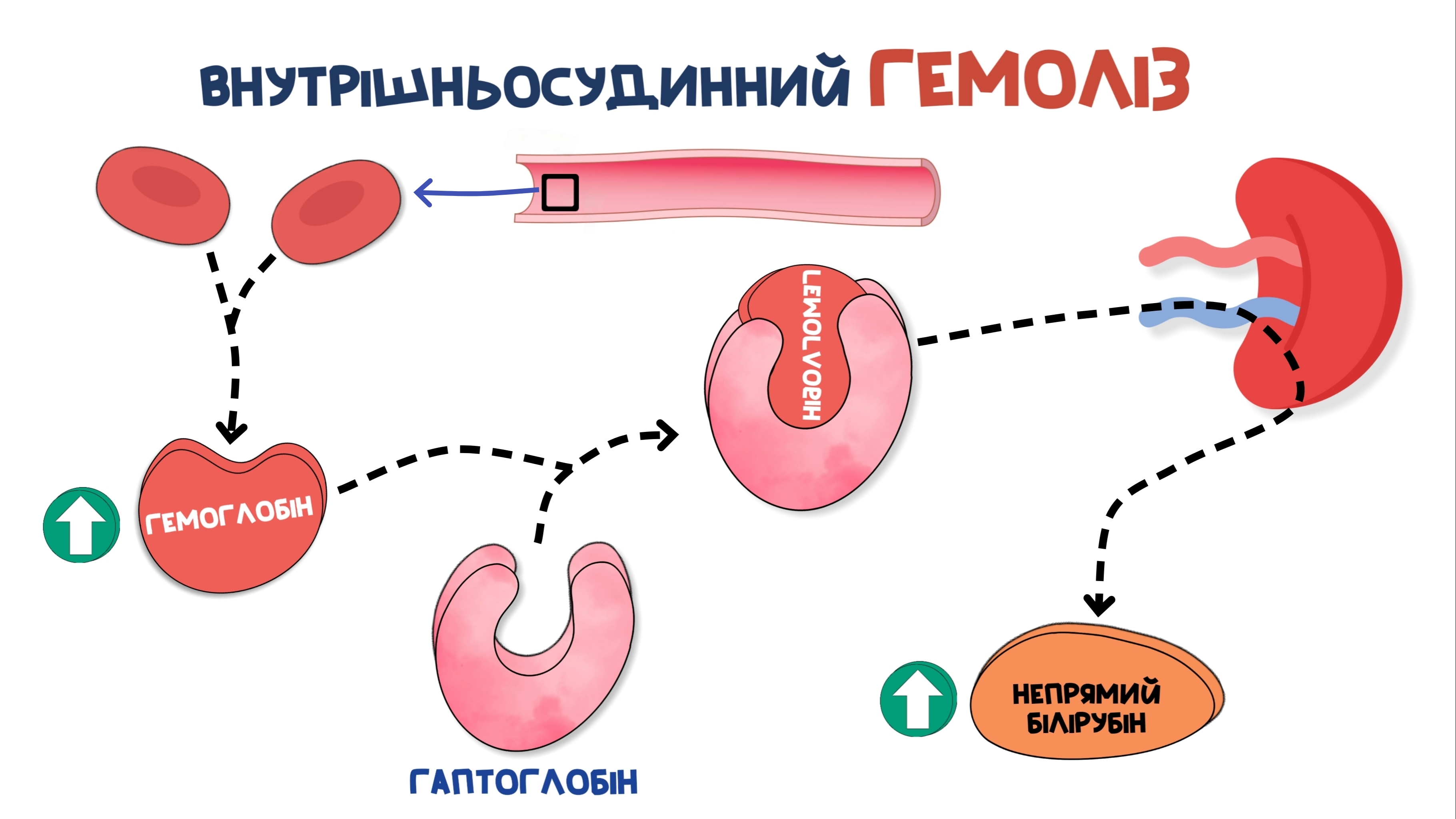 внутрішньосудинний гемоліз еритроцитів